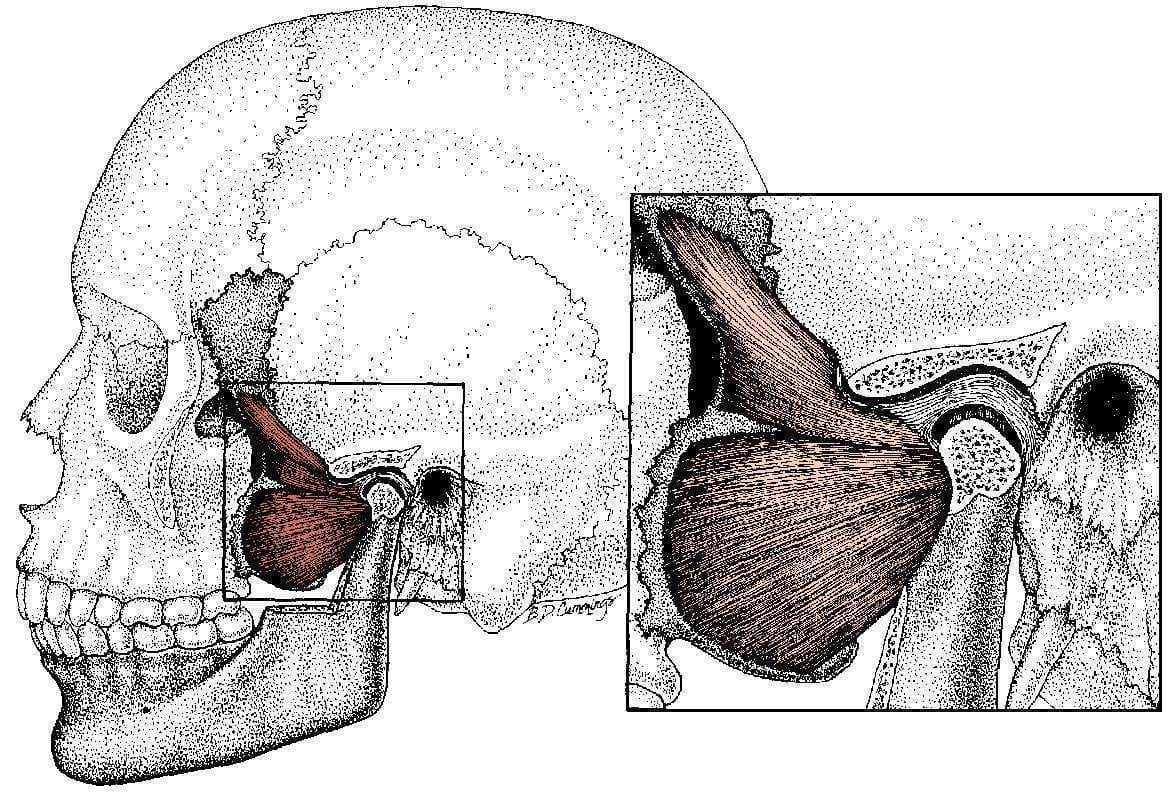 Lateral Pterygoid